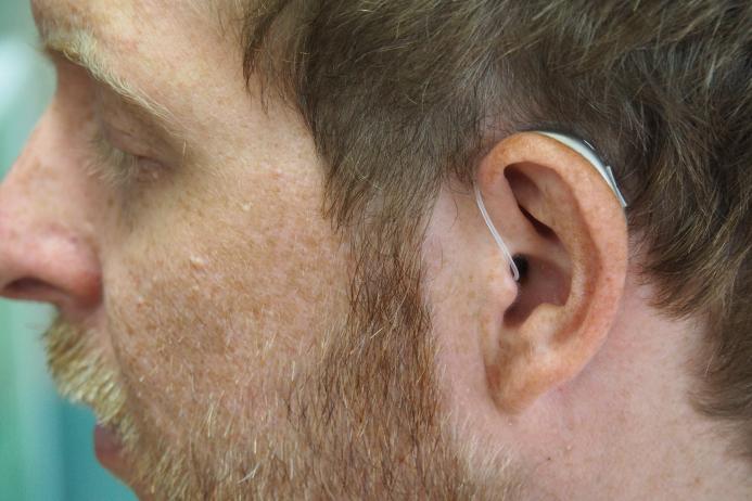 Close up of a man's head, wearing a hearing aid